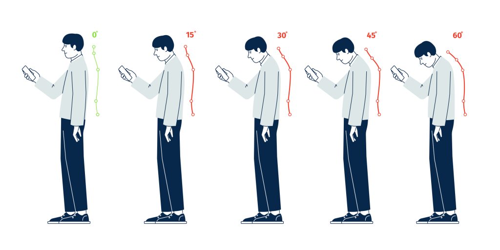 Text neck affecting posture